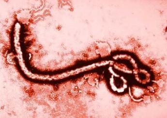 ebola-disease1_345